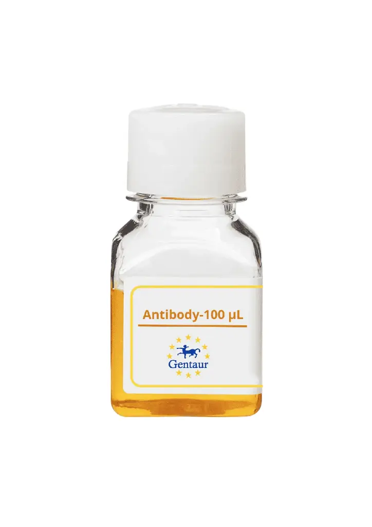 ALKBH3 Antibody  Biotin conjugated   